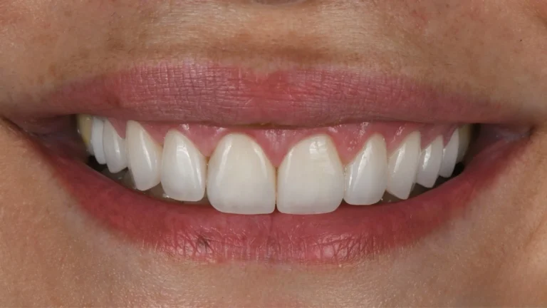 Dr. Ali Khodr - Dentist in Dubai