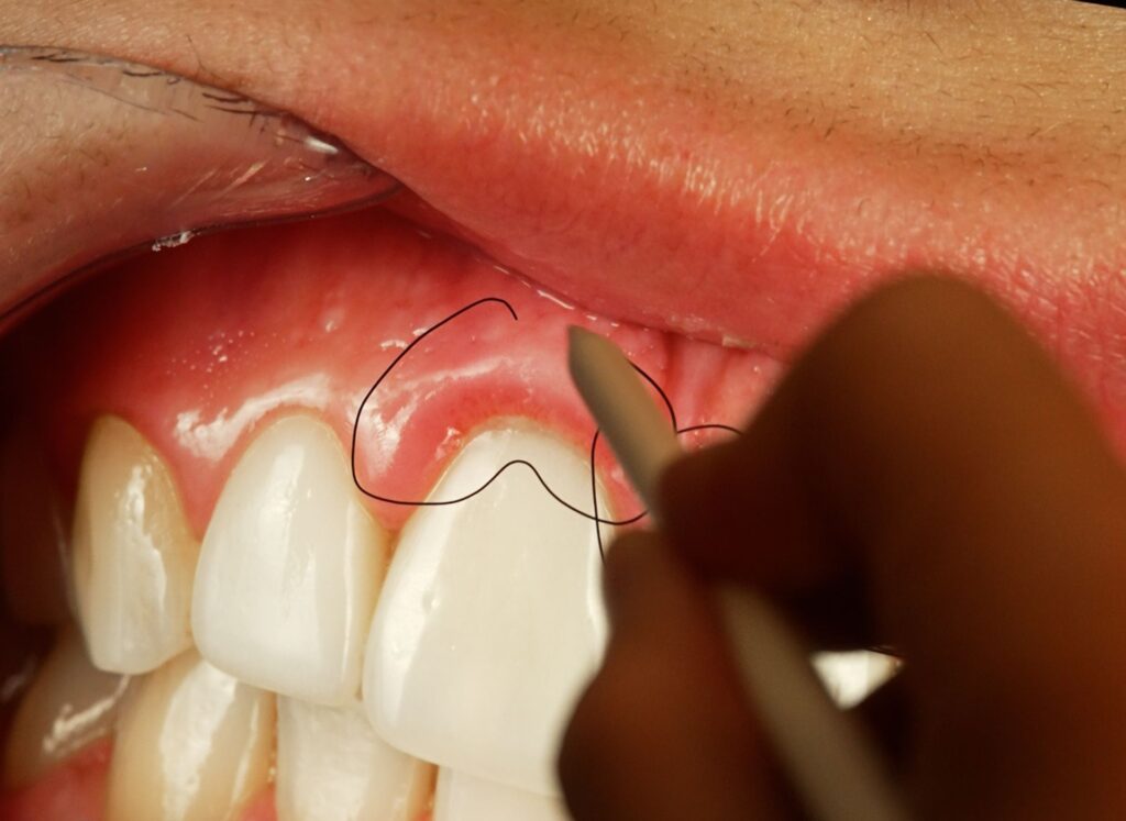 Dental Hygiene and Periodontology in Dubai